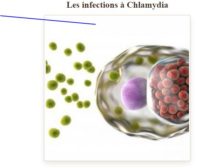 Natural Remedy Chlamydia Infection