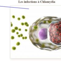 Natural Remedy Chlamydia Infection