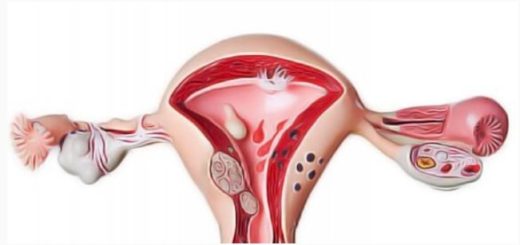 Natural Methods to Unblock Fallopian Tubes